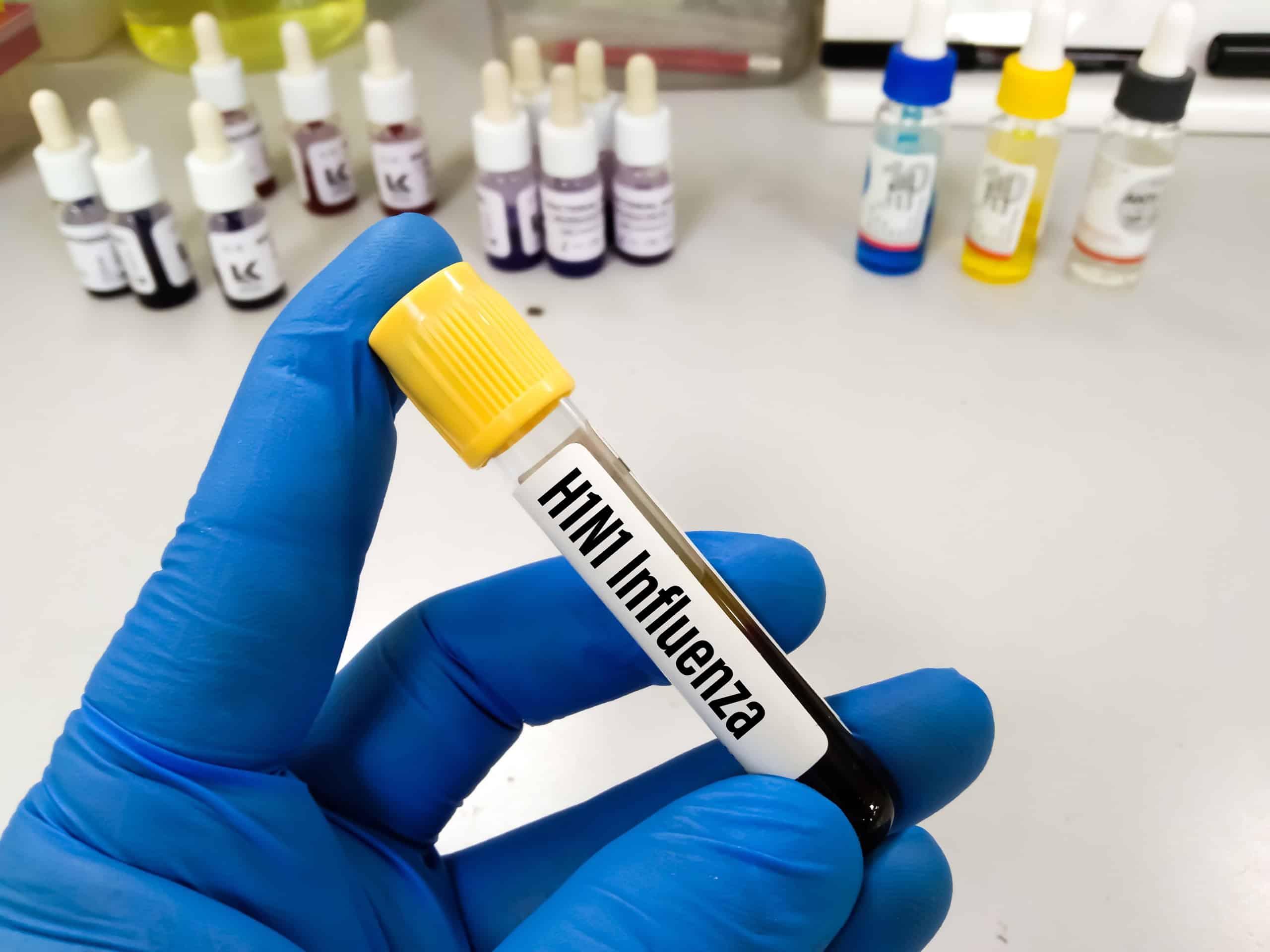 H1N1 está entre vírus furtados na Unicamp, diz site